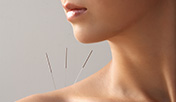 Acupuncture